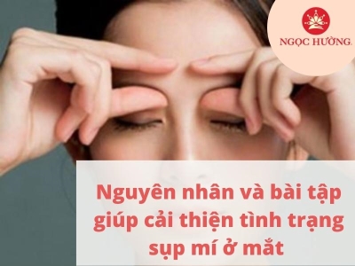 Nguyên nhân và bài tập giúp cải thiện tình trạng sụp mí ở mắt