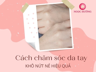 5 Cách Chữa Da Tay Khô Nứt Nẻ Hiệu Quả Ngay Tại Nhà