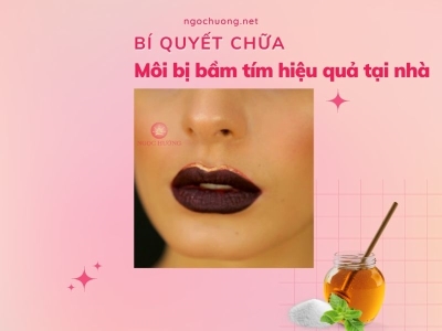 Cách chữa môi bị bầm tím hiệu quả ngay tại nhà