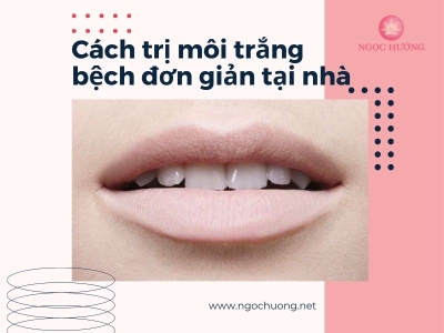 Chia Sẻ Cách Trị Môi Trắng Bệch Đơn Giản, Hiệu Quả Ngay Tại Nhà