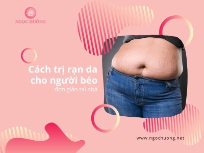 Bật Mí Cách Trị Rạn Da Cho Người Béo Đơn Giản Hiệu Quả Ngay Tại Nhà