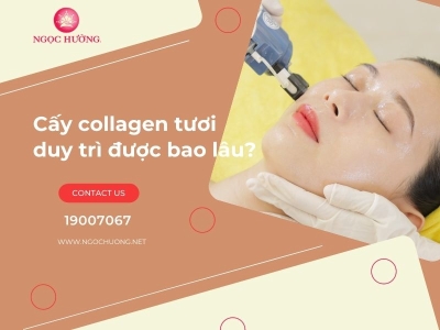 Cấy collagen tươi duy trì được bao lâu? 5 Lưu ý để đạt hiệu quả lâu dài