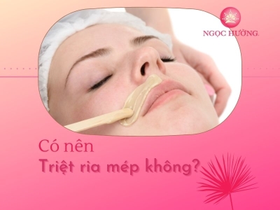 Có Nên Triệt Râu Ria Mép Không?