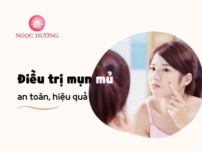 Cách Trị Mụn Mủ An Toàn Hiệu Quả Không Lo Bị Sẹo