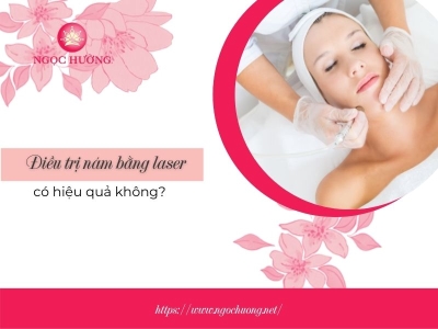 [Review] Điều trị nám bằng laser có hiệu quả không? Có hết không?