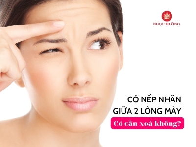 Người có nếp nhăn giữa 2 lông mày, có cần xoá bỏ hay không?