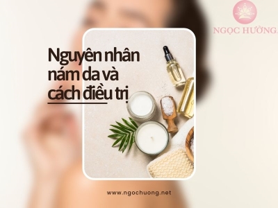 Nguyên Nhân Bị Tàn Nhang Và Cách Điều Trị Dứt Điểm