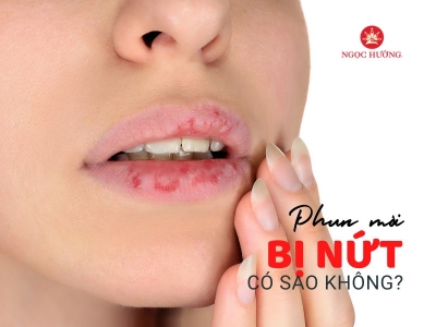 Sau Khi Phun Môi Bị Nứt Có Sao Không? Cách Điều Trị Hiệu Quả