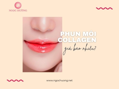 Phun môi collagen giá bao nhiêu là hợp lý? Cập nhật 2023