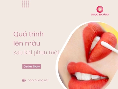 [60 Ngày] Quá trình phục hồi sau phun môi và 8 lưu ý cần biết