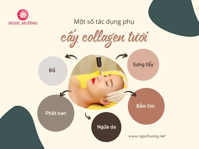 Tác dụng của cấy collagen tươi: Giải pháp làm đẹp hiệu quả cho làn da