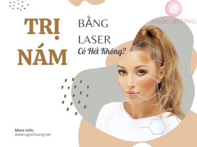 [Giải Đáp] Trị Nám Bằng Laser Có Hết Không?