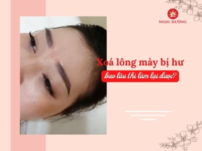 Xoá lông mày bao lâu thì làm lại được? Giải đáp từ chuyên gia