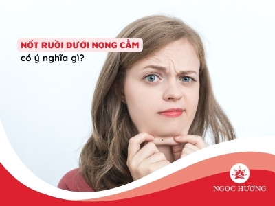 Ý nghĩa từng vị trí của nốt ruồi dưới nọng cằm phụ nữ