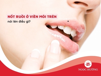 Nốt ruồi ở viền môi trên, môi dưới ở cả nam và nữ tiết lộ điều gì?