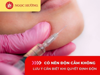 Có nên độn cằm không? Những lưu ý cần biết khi quyết định độn cằm