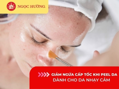 Giảm ngứa cấp tốc khi peel da dành cho da nhạy cảm