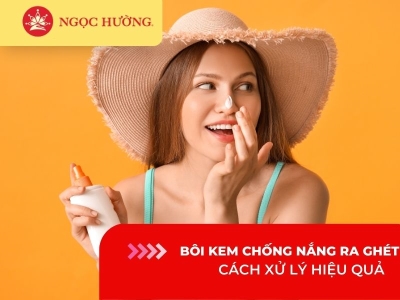 Tại sao bôi kem chống nắng bị ra ghét, cách xử lý hiệu quả