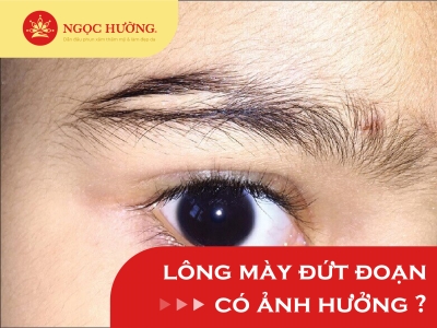 Lông mày đứt đoạn có ý nghĩa tốt hay xấu? Có nên chỉnh dáng mày?