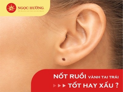 Ý nghĩa nốt ruồi ở vành tai phải phụ nữ, giàu sang hay khó khăn?