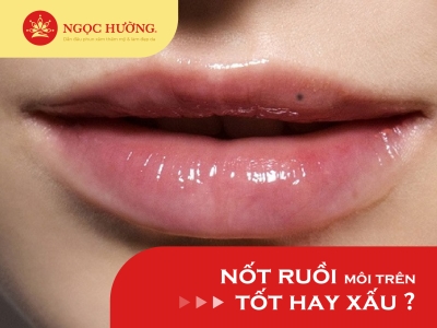 Ý nghĩa nốt ruồi ở môi trên phụ nữ là tốt hay là xấu?