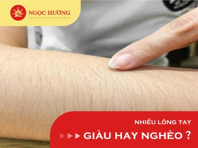 Luận tướng phụ nữ nhiều lông tay - Giàu sang hay nghèo khổ?