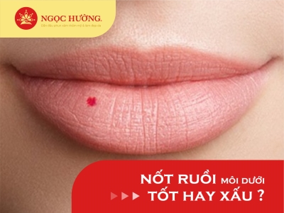 Nốt ruồi ở môi dưới bên phải phụ nữ vận mệnh Tốt hay xấu?