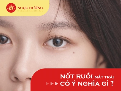 Nốt ruồi dưới mắt trái phụ nữ Tốt hay Xấu? Giàu hay Nghèo?