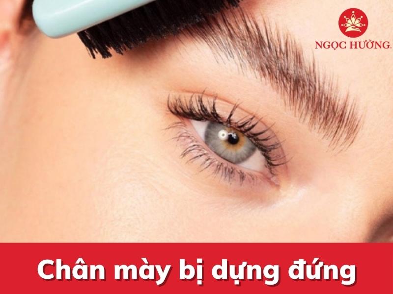 Chân mày bị dựng đứng