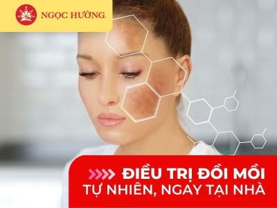 13 cách điều trị đồi mồi trên da mặt tại nhà hiệu quả trong 7 ngày