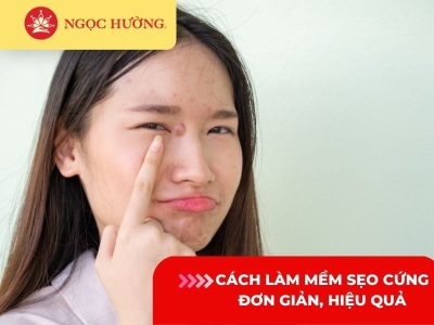 5 Cách làm mềm sẹo cứng đơn giản, hiệu quả nhất