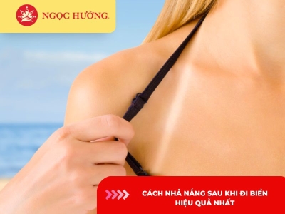 6 cách nhả nắng sau khi đi biển hiệu quả trong 7 ngày