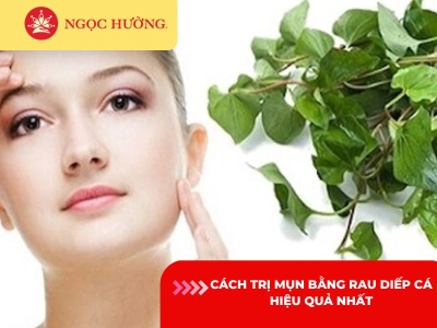 Cách trị mụn bằng rau diếp cá hiệu quả trong 7 ngày