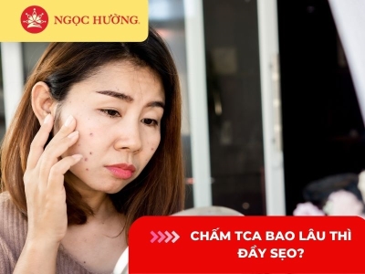 Chấm TCA bao lâu thì đầy sẹo? 5 điều cần biết khi chấm TCA