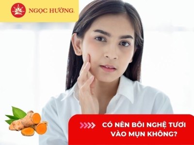 Có nên bôi nghệ tươi vào mụn? 4 cách trị mụn bằng nghệ tươi