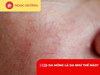 Da mỏng là da như thế nào? Cách nhận biết và cách phục hồi da mỏng yếu