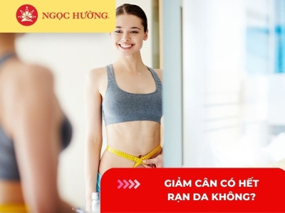 Giảm cân có hết rạn da không? 3 cách trị rạn da hiệu quả