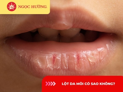 Lột da môi có sao không? Có bị thâm không? Cách khắc phục ra sao?