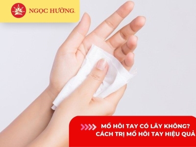 Mồ hôi tay có lây không? 6 cách trị mồ hôi tay dứt điểm nên biết