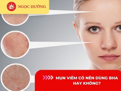 Mụn viêm có nên dùng BHA hay không? 5 Lưu ý khi dùng