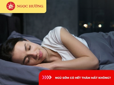 Ngủ sớm có hết thâm mắt không? 3 điều bạn nên biết