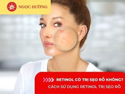 5 cách sử dụng Retinol trị sẹo rỗ an toàn hiệu quả