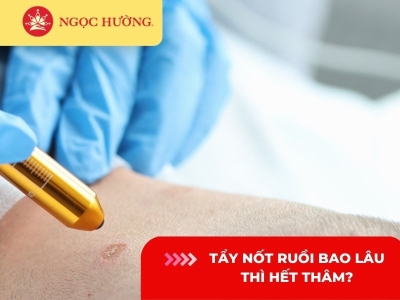 Tẩy nốt ruồi bao lâu thì hết thâm? 6 cách chăm sóc sau tẩy nốt ruồi