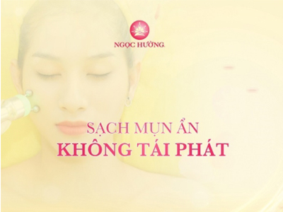 Phương Pháp Điều Trị Mụn Ẩn Dưới Da Tốt Nhất Hiện Nay