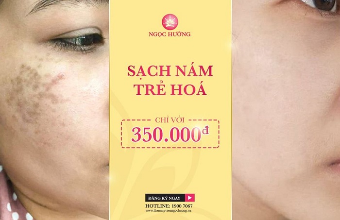 Hủy diệt nám tận góc với công nghệ Liposome hiện đại