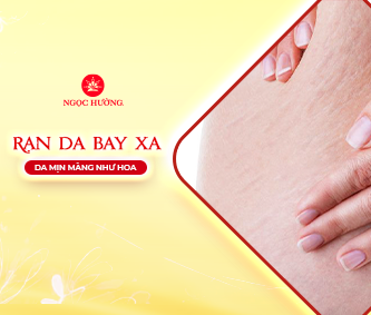 Rạn nứt da: Nguyên nhân và các cách chữa trị hiệu quả