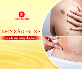 Cách Trị Sẹo Và Phòng Ngừa Hiệu Quả: