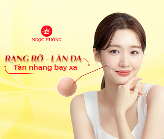 Các phương pháp xóa tàn nhang hiệu quả cho làn da sáng mịn