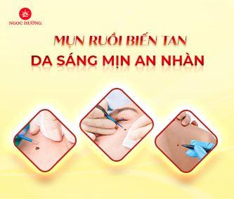 Các cách tẩy nốt ruồi hiệu quả