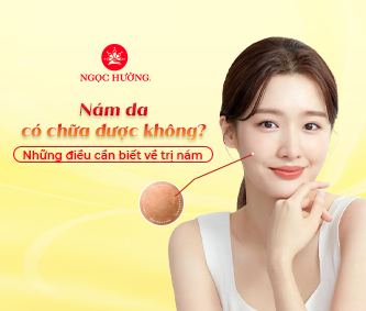 Nám da có chữa được không? Những điều cần biết về trị nám
